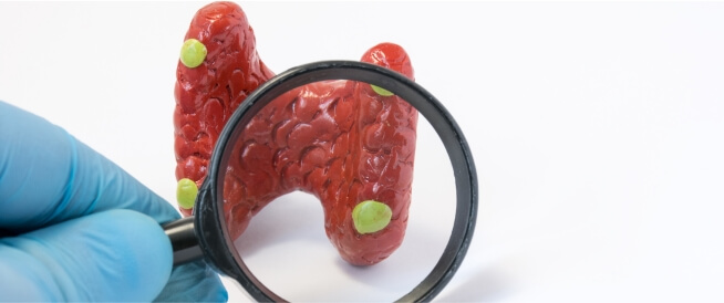 Endocrine Tumors