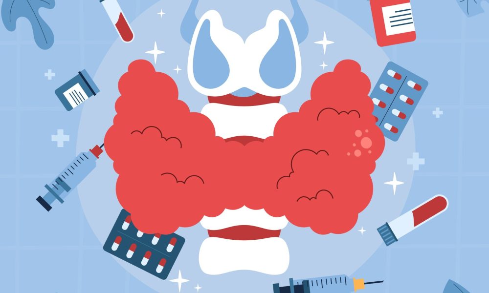Thyroid Cancer